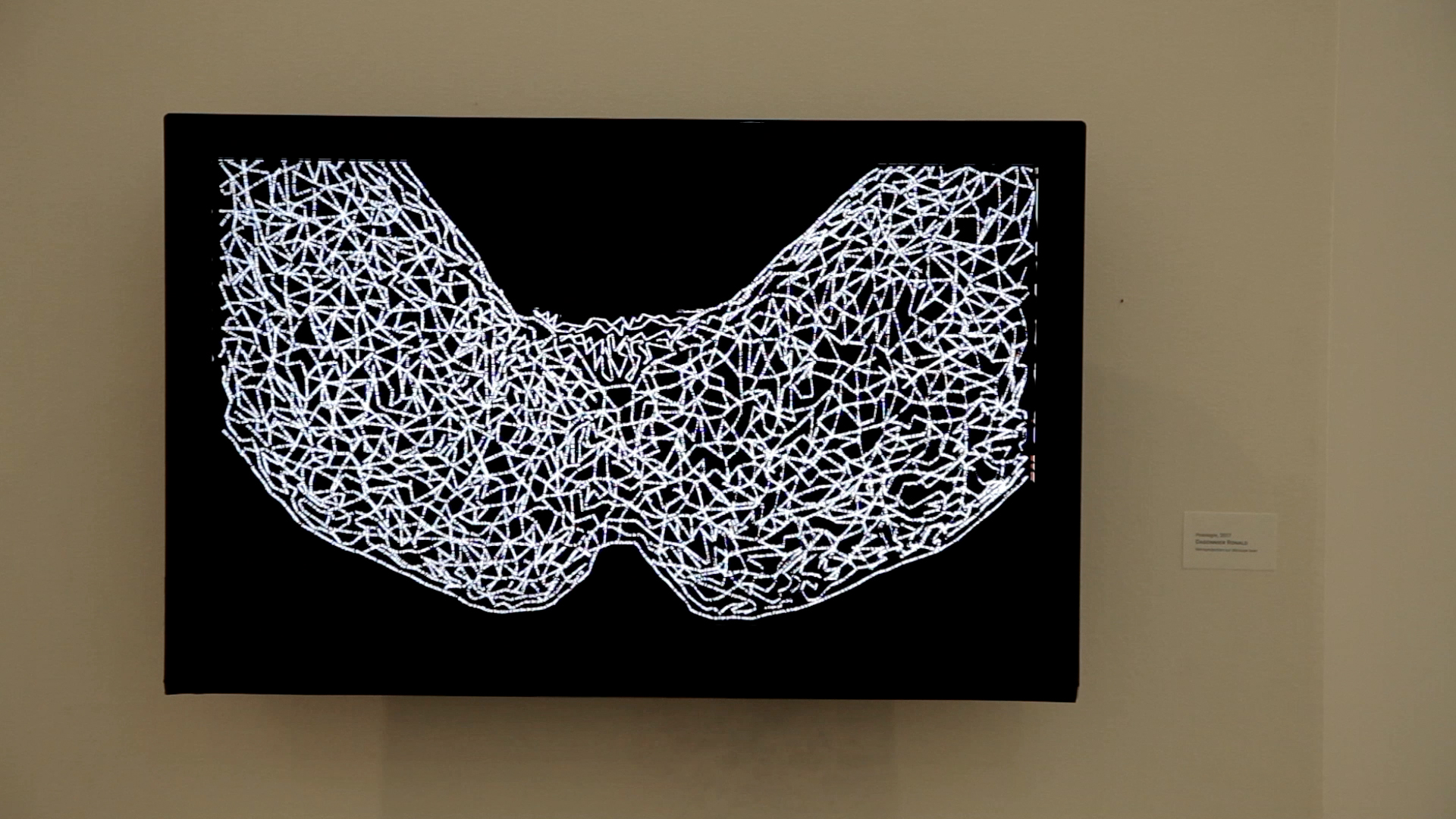 2017 Posologie  Exposition la lecon d'anatomie détail 03